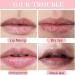 Lips Pink Bleaching Cream Balm Lip Lightening Scrub Balm Lip Lightening for Dark Lips Long Lasting Lip Care with Natural Oil Lip Care Lightens Remove Dark Lips for Women Moisturizing Lip Brightening - Buy Online on GoSupps.com