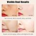 Vitamin C Serum for Face 30Capsules - Anti-Aging Vit C Face Oil - Dark Spot Correcting Glow Serum - Hydrating Facial Serum - Skin Care Serum for Uneven Skin Tone Anti-Wrinkle Reduces Fine Lines - Buy Online on GoSupps.com