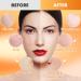 Poztl Jelly Mask Powder - Turmeric Anti-Fold Acne Gel Face Mask | Professional DIY Hydro-Facial Mask for Fine Lines & Uneven Skin Tone - 23 fl oz - Buy Online on GoSupps.com