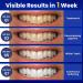 Teeth Whitening Strips - 28 Non-Sensitive Bleaching Strips for Home Use | Brighten Your Smile Today! - Buy Online on GoSupps.com