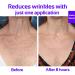 Silicone Anti Wrinkle Chest Pad Set - Reusable, Medical Grade, Smooth Skin - 2 Pads - Buy Online on GoSupps.com