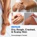 Cr me D'Uree 40% Cr me Pour Les Mains Eet Les Pieds 150g Convient Aux Peaux S ches Rugueuses Et Fissur es Maintient La Peau Humide Hydratante Pour Les Pieds Pours Hommes Femmes - Buy Online on GoSupps.com