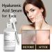 Hyaluronic Acid Serum for Hydrated Hyaluronic Acid For Face Hydrated Hyaluronic Acid Serum for Face Lightweight Face Serum Plump and Smooth Skin for All Skin Types Skin Care - Buy Online on GoSupps.com