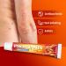 Itching Cream 20g - Restore Skin Barrier for Men & Women | Irritated Skin Relief - Buy Online on GoSupps.com