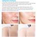 Moisturizing Honey Milk Cream - Anti-Acne Wrinkle Reduction & Pore Minimizer for Face & Body | 120ml - Buy Online on GoSupps.com
