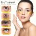24K Gold Under Eye Masks Gold Eye Masks for Dark Circles Anti Wrinkle Treatment Under Eye Gel Pads Eye Mask for Puffy Eyes Skincare Hydrating (60 Pieces/30 Pair). - Buy Online on GoSupps.com