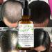 DISAAR BEAUTY Hair Growth Essential Oil 30g - Natural Plant Dry Growth Essence for Anti Hair Loss and Scalp Treatments with Genseng for Dense Hair - Buy Online on GoSupps.com