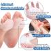 14 Pairs Gel Metatarsal Pads & Toe Separators - Premium Heel Grips & Forefoot Cushions for Comfort | Reusable & Breathable Insoles - Buy Online on GoSupps.com