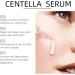 Centella Asiatica Hydrating Serum Centella Asiatica Face Serum Centella Face Serum with Hyaluronic Acid Calming Soothing Hydrating Serum Hyaluronic Acid Serum Anti Wrinkle Serum Serums Skincare 30ML - Buy Online on GoSupps.com