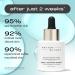 MATTER OF FACT Barrier + Antioxidant Treatment Lipids Bakuchiol & Squalane Oil Serum for Hydration and Skin Barrier Support 30mL / 1.0 Fl Oz - Buy Online on GoSupps.com
