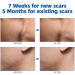 Silicone Scar Cream Gel - Effective Scar Removal for Face & Body | Treat Surgical Scars Stretch Marks Acne & More - 1.05 oz - Buy Online on GoSupps.com