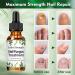 Fungal Nail Treatment 30ML - Extra Strong Solution for Toenails & Fingernails - Restores Healthy Nails - Protects Thick, Broken, and Discolored Nails - Green-1 - Buy Online on GoSupps.com
