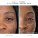 HERBIVORE Brightening + Smoothing Duo | Nova Serum & Moon Fruit Serum for Radiant Skin - Buy Internationally - Buy Online on GoSupps.com
