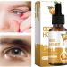  demaxiyad Soothing Eye Dropping - Lubricant for Dry Eyes Natural Liquid Solution with Accurate Dropper Tip for Adults and Seniors Sensitive Skin Care Screen Users - Buy Online on GoSupps.com