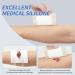 Doctor.Roo Silicone Adhesive Foam Dressing 4x4 Waterproof Bandage 10-Pack - for Surgical Wounds, Bed Sores, Leg Ulcers, Diabetic Ulcers, Acne, Blisters, Burns - Buy Online on GoSupps.com