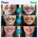 Buy Dentiz Gum Therapy Gel | Effective Gum Disease Treatment & Tooth Elevator | Teeth Whitening Solutions - Buy Online on GoSupps.com