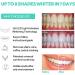16x Powerful Blue LED Teeth Whitening Light with Smartphone Connectivity for Home Use - Buy Online on GoSupps.com
