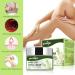 Varicose Vein Cream for Soothing Relief and Improved Capillary Health - Buy Online on GoSupps.com