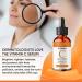 Vitamin C Hyaluronic Acid Serum for Face | Anti Aging, Dark Spot, Wrinkle, Acne Scar Treatment - Buy Online on GoSupps.com