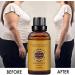 Buy Premium Ginger Oil for Lymphatic Drainage - 30ml Massage Oil | Essential Spa Oil for Relaxation - Buy Online on GoSupps.com