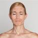 Skin-Remide Anti-Folds Transparent Glue Patches for Facial Lines - Forehead Smile Crow's Feet & Wrinkle Solution - Buy Online on GoSupps.com