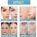Gla-Mory Micro-Infusion System for Lips Gla-Mory Micro System for Face Hyaluronic Acid Serum Gla-Moryfacial System with Hydrating Serum Smooth Face Serum for Women Skincare Anti Aging Serum for Face - Buy Online on GoSupps.com
