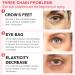 Retinol Eye Stick & Cream for Dark Circles, Puffiness & Anti Aging - Reduces Fine Lines - Buy Online on GoSupps.com