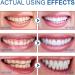 SP-6 Probiotics Ultra White Toothpaste - Brighten Your Smile & Freshen Breath | International Shipping - Buy Online on GoSupps.com