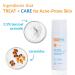 Acne Free Facial Cleansing Brush and Oil-Free Acne Treatment Kit with Benzoyl Peroxide 2.5% - Glycolic Acid Formula | Gentle Face Cleanser for Clear Skin - Buy Online on GoSupps.com