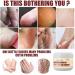 Vegan Foot Cream for Dry Rough & Cracked Feet | Best Callus Care - International Shipping - Buy Online on GoSupps.com