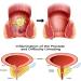 Tonkog Heca Natural Herbal Strength Hemorrhoid Capsules - Pack of 3 - Buy Online on GoSupps.com