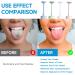 4 Pack Tongue Scraper Cleaners with Travel Case | Effective Oral Care for Adults & Kids - Fight Bad Breath Easily - Buy Online on GoSupps.com