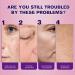 3PCS Vitamin B3 Facial Serum Dark Spots Remover Fade Marks Freckle Melanin Correcting Anti Pigmentation Brighten Care Essence - Buy Online on GoSupps.com
