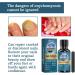 Fungal Nail Treatment - Extra Strong Nail Fungus Treatment for Toenail and Fingernail - Fungal Nail Eliminator Anti fungus Nail Repair and Strengthen Fix & Renew Damaged Broken Nails 30ml - Buy Online on GoSupps.com