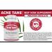 Acne Tame 120 Pills & Estrohalt Combo - Best Solution for Clearing Acne - Buy Online on GoSupps.com