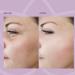 Anti Aging Collagen Face Cream with EGF for Stem Cell Rejuvenation | Wrinkle Repair & Collagen Production - 30mL - Buy Online on GoSupps.com