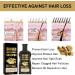 Ginger Hair Growth Shampoo Ginger Shampoo Anti hair Loss Shampoo Hair Regrowth Treatment for Men Woman Mens Shampoo Hair Growth Shampoo and Conditioner Anti Dandruff Shampoo Men - Buy Online on GoSupps.com