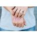 Prosoria Psoriasis Treatment Gel - 2oz Topical Relief for Dry, Itchy Skin - Reduces Scaling, Flaking, and Irritation - Buy Online on GoSupps.com