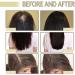 Veganic Natural Hair Growth Oil - Carvenchi Organic Rosemary Oil for Hair Growth Vegan Hair Oil for Dry and Damaged Hair Promotes Growth and Thickness - Buy Online on GoSupps.com