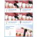 Rechargeable Tooth Polisher Kit - Teeth Whitening & Tartar Removal Tools for Home Use | Includes 3 Polish Pastes & 5 Brush Heads - Buy Online on GoSupps.com