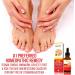 Natural Nail & Toenail Repair Treatment - Extra Strength Drops for Nails, Athlete's Feet, Jock Itch, Ringworm & Skin Rash - USA Made - Buy Online on GoSupps.com