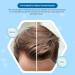 Tricovit Forte Hair Lotion - Hair Growth Serum for Thinning Hair - With Androgen & DHT Blockers - Promotes Stronger, Thicker Hair - Men & Women - 5 Ampoules - Buy Online on GoSupps.com
