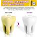 Teeth Whitener - Yellow Smoke Stain Remover & Tooth Color Corrector | 60ml for Effective Teeth Cleaning & Whitening - Buy Online on GoSupps.com