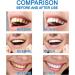 Dazzlewhite Teeth Whitening Essence - Intensive Stain Removal Gel for Sensitive Teeth (3PCS) | Reduce Yellowing & Achieve a Brighter Smile - Buy Online on GoSupps.com