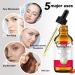 Rosehip Oil 60 ml for Face Care Anti-Aging Skin Scars and Stretch Marks Hair Moisturizes Body Skin Cold Pressed Skin Pure and Natural Moisturizing and Nourishing - Buy Online on GoSupps.com