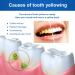 New Propolis Teeth Regrow Dental Gel & Whitening Pen Set | Effective Teeth Bleaching & Stain Removal - Buy Online on GoSupps.com