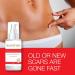 NEUTRAFADE RECOVERY OIL SKIN RECOVERY SCAR OIL FADING OIL - FADES COLOR - Buy Online on GoSupps.com
