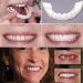 Cosmetic Snap-On Teeth Veneers | Perfect Smile | 2 Pairs - Top & Bottom Artificial Teeth - Buy Online on GoSupps.com