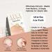 AINA Hydrocolloid Pimple Patches - Invisible Acne Spot Dots | Clear Natural Zit Patches | 48 Dots + Bonus Chin & Nose Patches - Buy Online on GoSupps.com