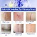 Silicone Scar Sheet Tape - Softens & Flattens Surgery, Injury, Burn, C-Section Scars - Safe & Painless Scar Removal - 1.6 x 120 Inch - Buy Online on GoSupps.com